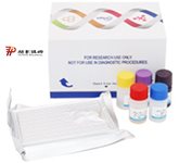 人促肾上腺皮质激素释放因子(CRF)ELISA试剂盒产品图片