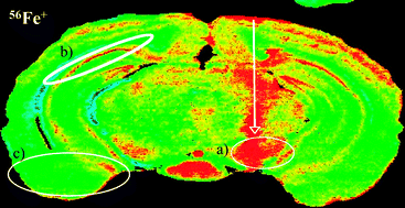 Graphical abstract: Quantitative elemental bio-imaging of Mn, Fe, Cu and Zn in 6-hydroxydopamine induced Parkinsonism mouse models