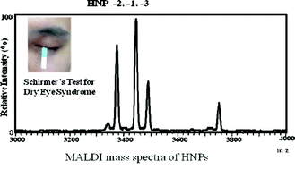 Graphical abstract: Characterization of human neutrophil peptides (α-Defensins) in the tears of dry eye patients