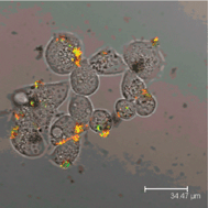 Graphical abstract: Gold nanorod–sphingosine kinase siRNA nanocomplexes: a novel therapeutic tool for potent radiosensitization of head and neck cancer