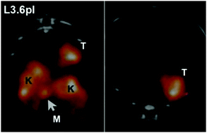 Graphical abstract: Targeted nanoparticles in imaging: paving the way for personalized medicine in the battle against cancer