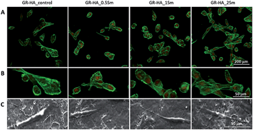 Graphical abstract: Samarium doped glass-reinforced hydroxyapatite with enhanced osteoblastic performance and antibacterial properties for bone tissue regeneration