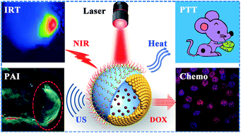 Precise synthesis of unique polydopamine/mesoporous calcium phosphate ...