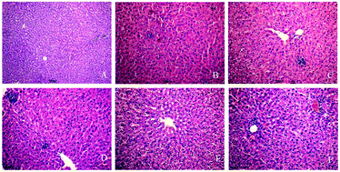 Graphical abstract: Involvement of histone hypoacetylation in INH-induced rat liver injury