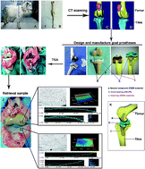 Graphical abstract: Characteristics of wear particles and wear behavior of retrieved PEEK-on-HXLPE total knee implants: a preliminary study