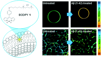 Graphical abstract: Molecular rotors report on changes in live cell plasma membrane microviscosity upon interaction with beta-amyloid aggregates