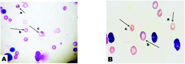 Graphical abstract: Genoprotective effects of gallic acid against cisplatin induced genotoxicity in bone marrow cells of mice