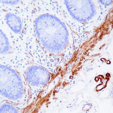 Primary Antibody Diluent价格,详情介绍-960化工网 – 960化工网