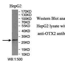 OTX2 Antibody价格,详情介绍-960化工网 – 960化工网