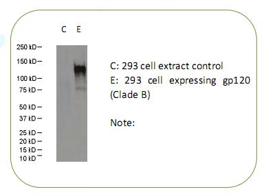 gp120/160(Clade B) HIV 抗体 艾滋病 gp120 gp160 GP120 GP160价格,详情介绍-960化工网 – ...