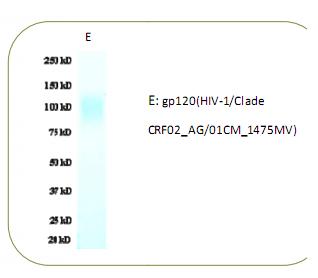 gp120(HIV-1/Clade CRF02_AG/01CM_1475MV) 艾滋病 HIV 抗原 蛋白 gp120 GP120价格,详情 ...