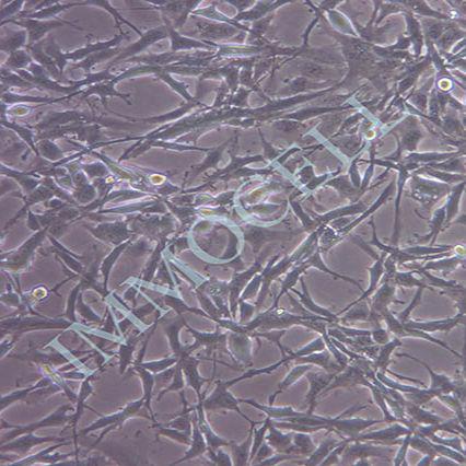 HEY 卵巢癌细胞(STR鉴定)丨hey细胞