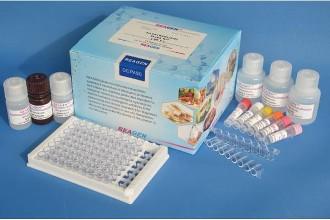 自身免疫调节因子(AIRE)ELISA试剂盒