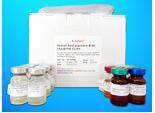 Olfactory Receptor 1L1 (OR1L1) ELISA Kit, Human价格,详情介绍-960化工网 – 960化工网