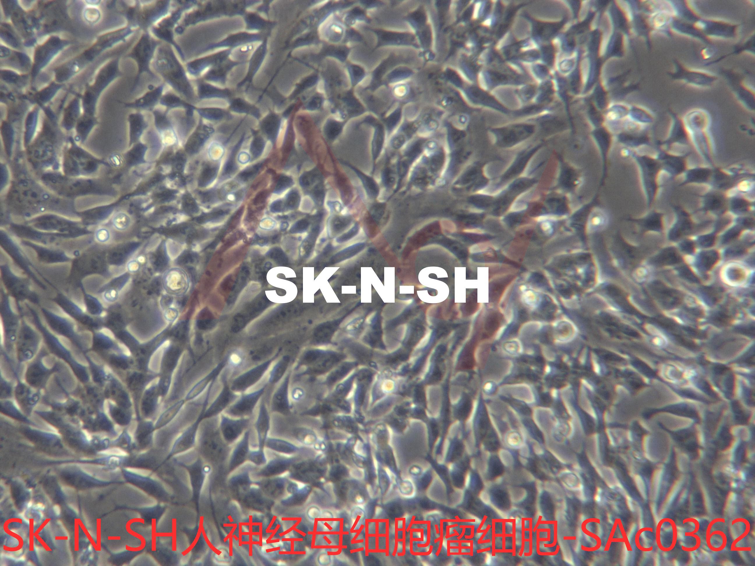 SK-N-SH【 SK N SH; SKN-SH; SK-NSH; SKNSH; NSH】人神经母细胞瘤细胞价格,详情介绍-960化工网 – ...