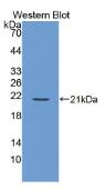 信号淋巴细胞激活分子家族成员7(SLAMF7）多克隆抗体