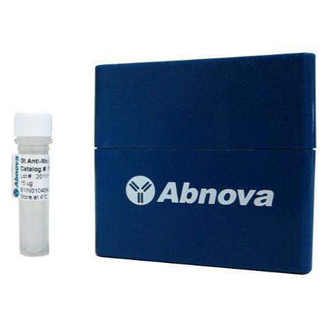 HLA-G|HLA-G抗体|HLA-G单抗|HLA-G单克隆抗体|HLA-G antibody|HLA-G monoclonal ...