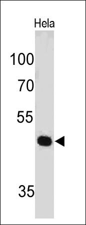 PAX7 antibody [PAX7/497]价格,详情介绍-960化工网 – 960化工网