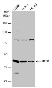 MEFV antibody [N3C1], Internal价格,详情介绍-960化工网 – 960化工网