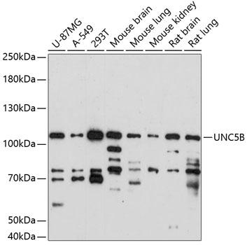 UNC5B antibody价格,详情介绍-960化工网 – 960化工网