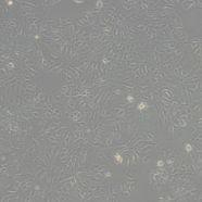 小鼠胰岛素瘤胰岛β细胞Beta-TC-6