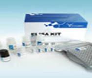 小鼠丙氨酸转氨酶/谷丙转氨酶(ALT/GPT)ELISA Kit