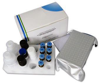 小鼠丙氨酸转氨酶/谷丙转氨酶(ALT/GPT)ELISA酶联免疫试剂盒