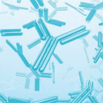 IGF-IR rabbit Polyclonal Antibody | IGF-IR Antibody | IGF-IR抗体